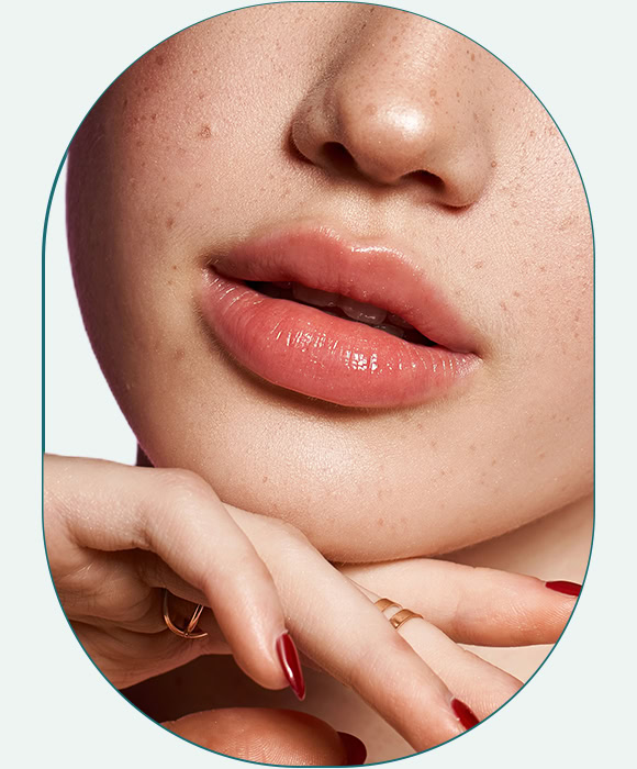 Zvětšení rtů / Augmentace rtů
